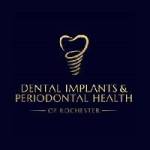 Dental Implants Periodontal Health Profile Picture
